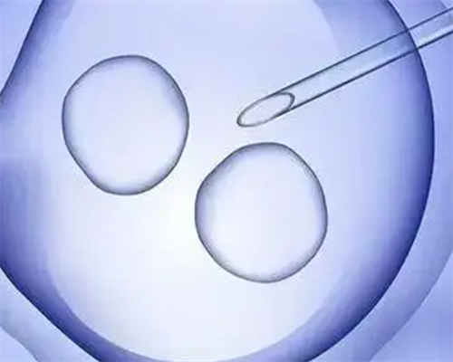 试管婴儿上海苏州哪里好(试管婴儿上海3家医院)