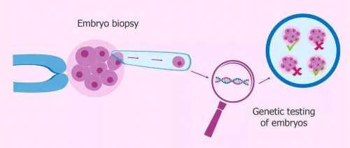 上海助孕宝宝反复湿疹是过敏体质吗？上海助孕宝宝湿疹反复怎么办？