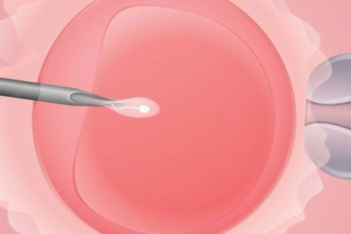 试管婴儿新技术,助力试管婴儿成功率提高