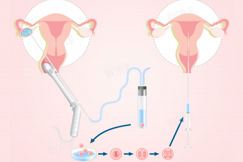 上海供卵和哪里好,广西钦州试管婴儿补贴有吗？可以医保报销吗？-上海供卵试