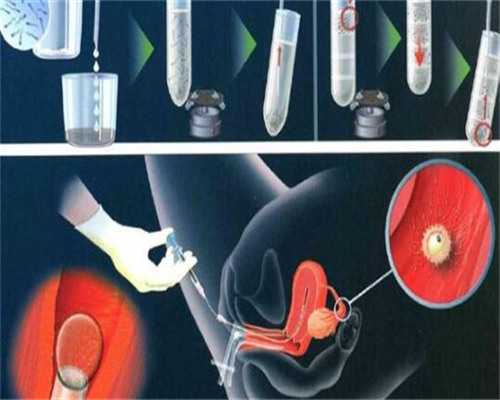 借卵NO1上海天使助孕泰斗