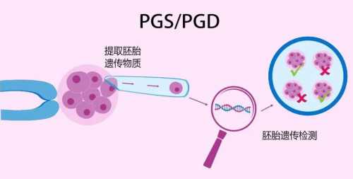 上海正规代生中介,试管婴儿移植后需要保胎多久?移植后的4大注意事项要知道