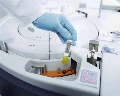 上海捐卵试管有无风险,上海捐卵多少钱_机构借卵靠谱吗