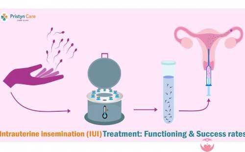 上海助孕宝宝有眼屎尿黄上海助孕宝宝有眼屎尿黄是怎么回事
