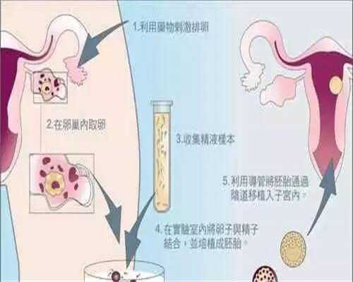 上海助孕宝宝绿便怎么改善,上海助孕宝宝腹泻该怎么喂养