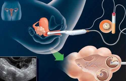 上海代孕公司好吗,上海国际医学中心试管婴儿成功率高吗？一次试管能成功吗