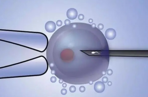 上海仁济-供卵过程,上海供卵试管费用是多少钱_卵子库