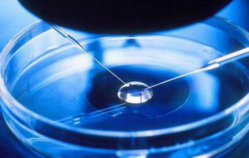 上海世纪供卵试管，上海世纪助孕集团官网