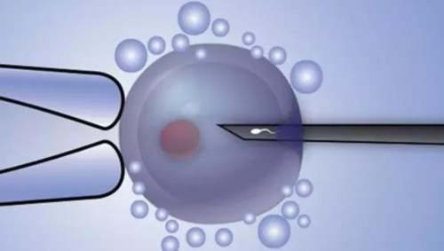 上海仁济医院供卵流程,上海供卵试管中介机构-代生咨询