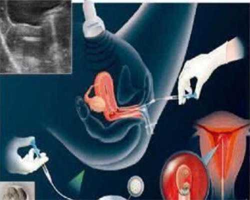 上海捐卵试管有无风险,上海捐卵多少钱-最好的代孕医院