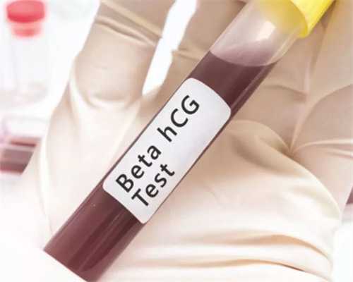 上海捐卵多少钱,上海捐卵试管有无风险-正规靠谱代孕