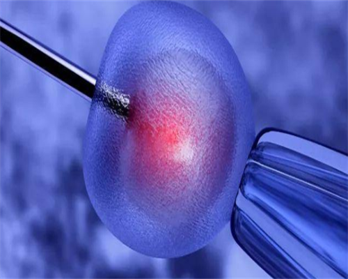 上海最好的代孕机构,精子成活率低很难怀孕可以去做试管婴儿吗？-上海供卵试