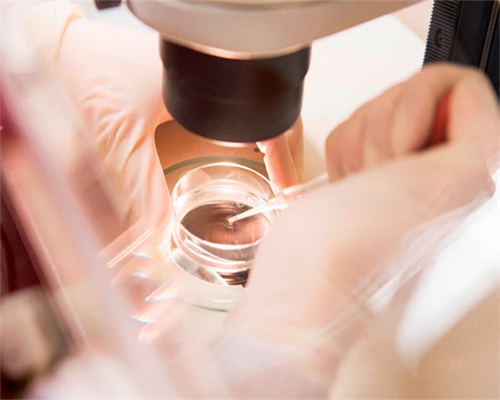 试管婴儿费用大约多少上海