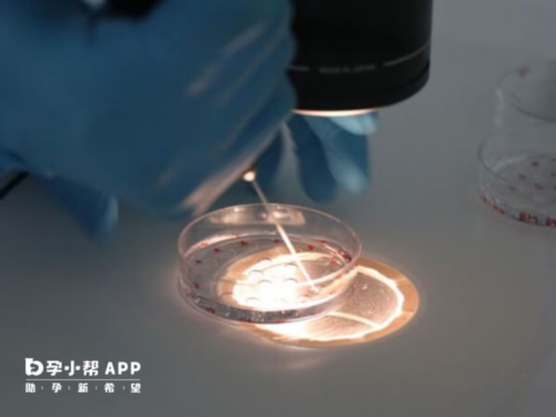 上海代生总价格,上海供卵助孕选性别包生男孩，美国第三代试管婴儿选性别多