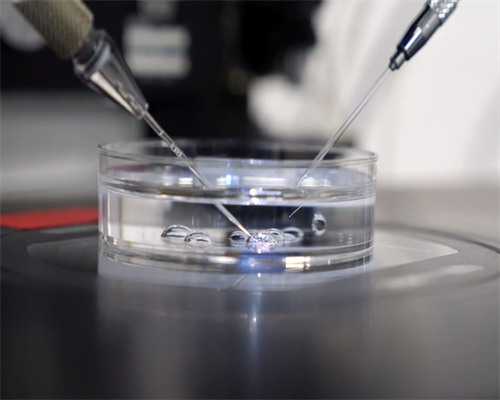 上海助孕宝宝湿疹会自愈吗