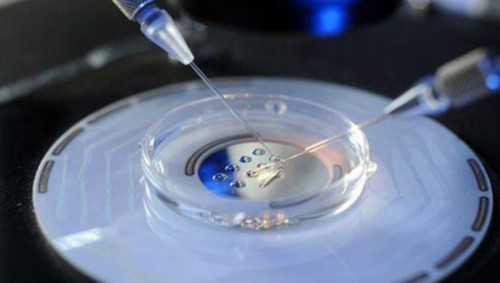 上海捐卵试管有无风险,上海捐卵多少钱_供卵包生双胎