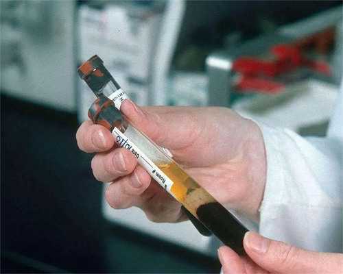 上海试管婴儿二代,上海试管婴儿费用