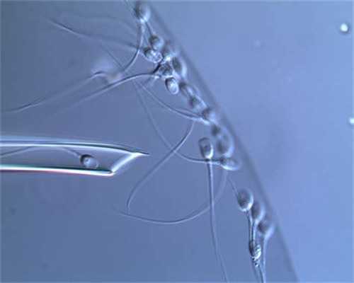 上海代怀公司哪家,2026上海试管助孕生混血宝宝费用参考,附全套检查项目花费