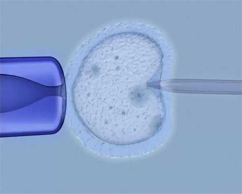 上海生子的费用