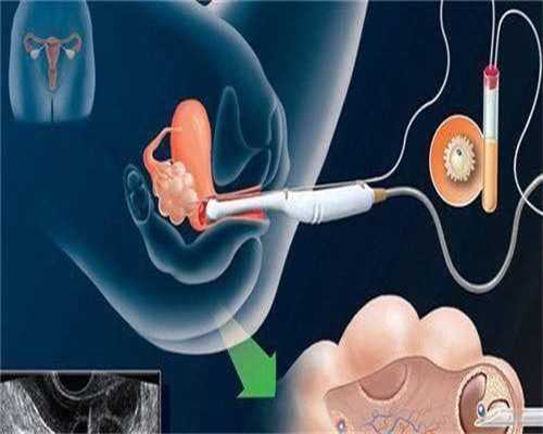 上海助孕宝宝发烧8小妙招