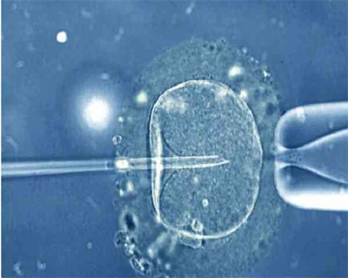 上海供卵正规机构,试管婴儿男性需要检查什么项目-上海供卵试管公司有哪些