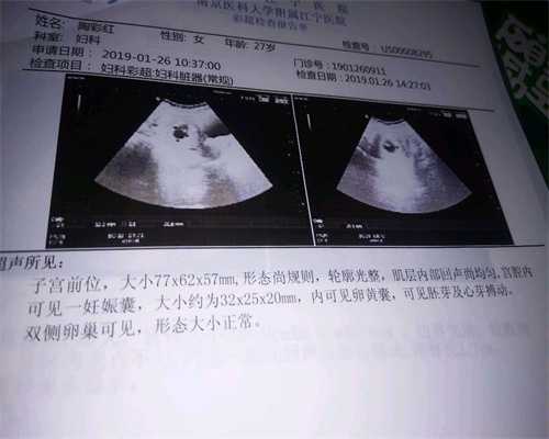 代孕几个月开始数胎动，代孕几周开始有胎动_北