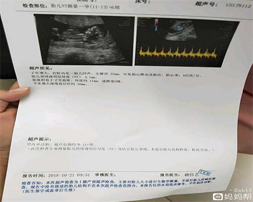 深圳代孕黑幕：視頻記錄我在臺灣的順產過程有