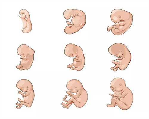 宫外孕早期症状会影响再次怀孕吗www.yidianzixun.