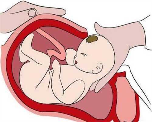 不孕不育图片广告：血脂高怀孕有影响吗