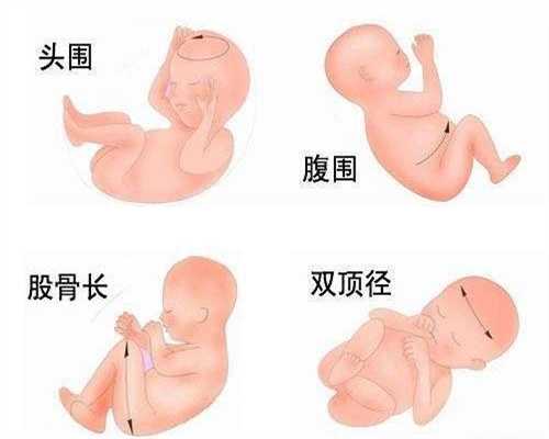 人工受孕的方法：奶粉断货 乳企打响宝宝口粮保