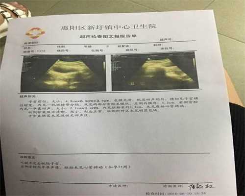 上海助孕公司排名,多数“意外怀孕”都不是意外