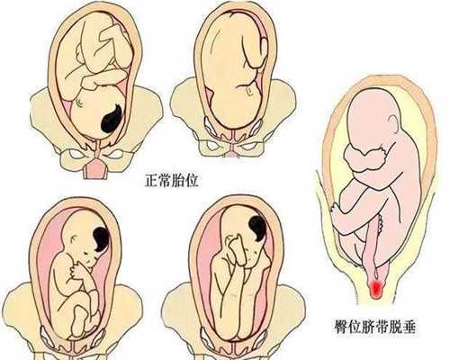 上海助孕公司排名,多数“意外怀孕”都不是意外