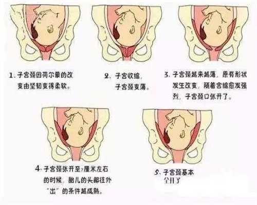 上海代孕案判决书,女子为了避孕，一直服用避孕