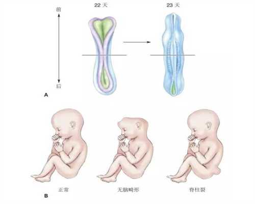上海世纪代孕简介,孕期这4点会增大孩子长胎记的