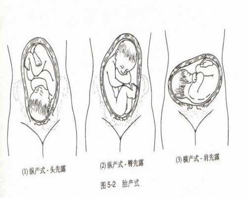 上海助孕中介哪家好,怀孕期间吃什么可以让宝宝