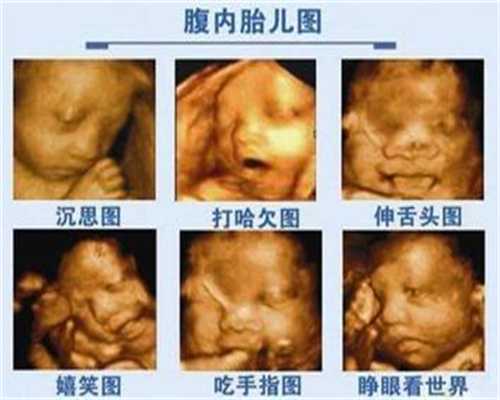 上海代孕网：孕期吃什么可以让宝宝皮肤白