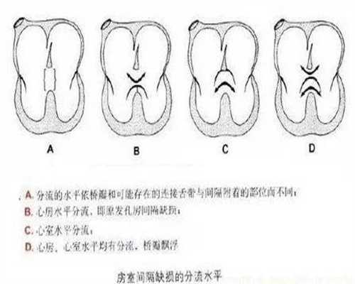 上海代孕在线咨询_孕妇吃红豆可以去胎毒吗