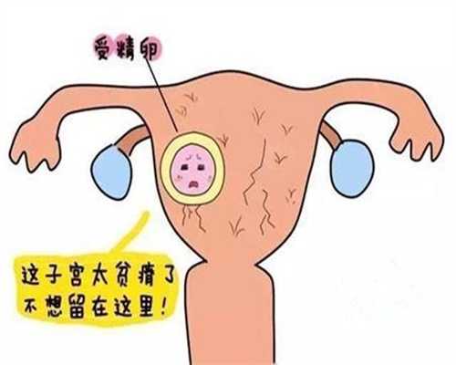 上海代孕哪里正规_孕妇顺产需要插尿管吗