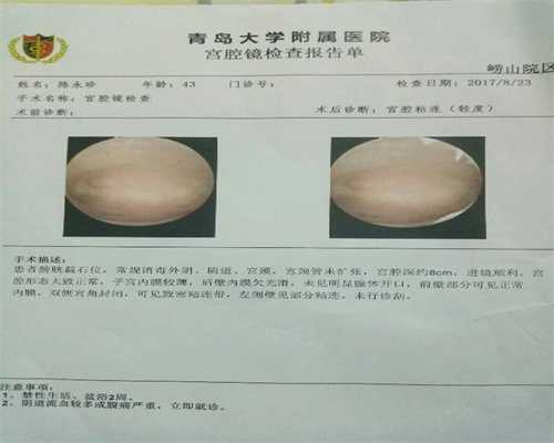 上海代孕公司怎么找_来月经感冒了怎么办