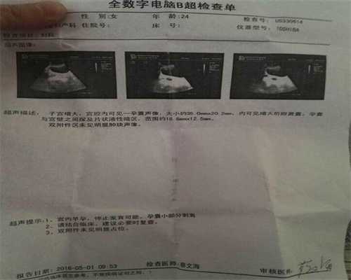 上海找个代孕的_女人肾虚的症状有哪些