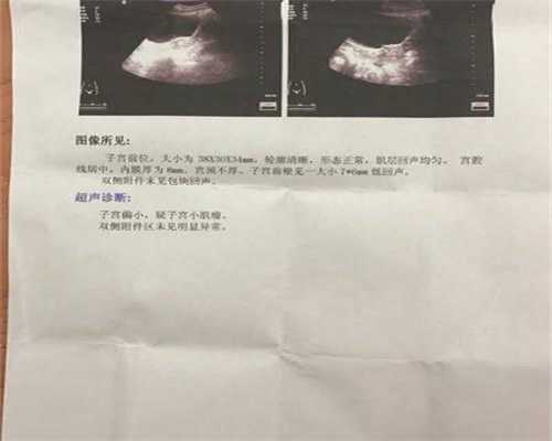 上海代孕2020_人工流产次数多会致子宫肌瘤 需要进行适当的家庭护理