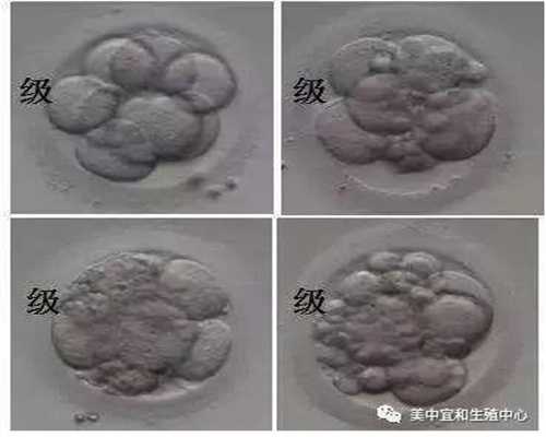 上海正规代孕价格_十个月宝宝辅食食谱有哪些