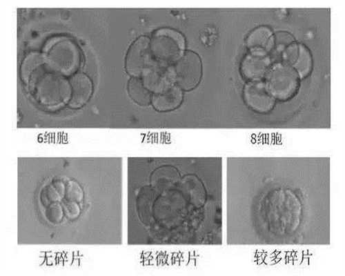 上海代孕的手术费用_卵子能够存活多久呢 卵子存活时间段意味着什么