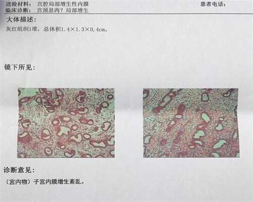 上海哪个医院能代孕_为什么排卵期会出血 排卵期会出血正常吗