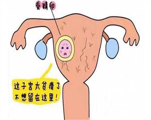 上海哪里有代孕的女人_药流排不出孕囊的原因