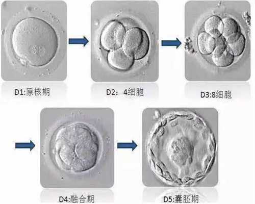上海想找代孕工作_针对宝宝湿疹 用心护理最关键