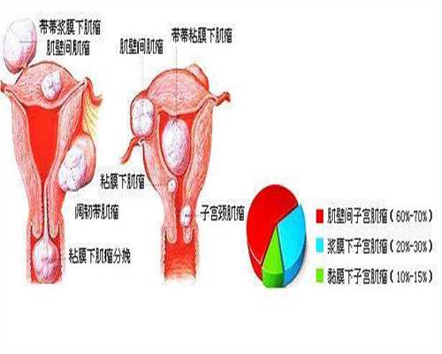 上海代孕条件-上海允许代孕吗-上海代生宝宝在线咨询