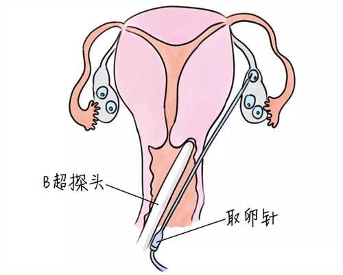上海代孕网,上海医院生殖中心,上海代怀孩子哪家优惠