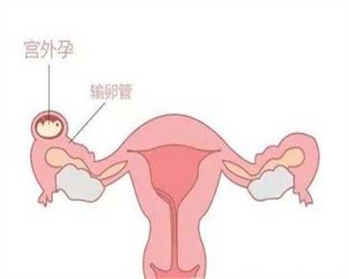 上海代孕公司,上海代孕是否犯法,上海代孕机构包生男孩