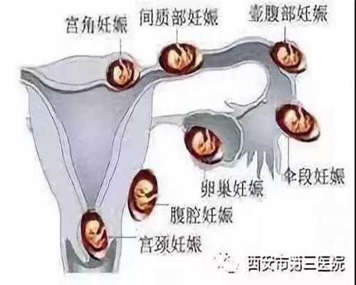 上海代孕生仔-上海试管中心官网-上海代孕中介官方网站